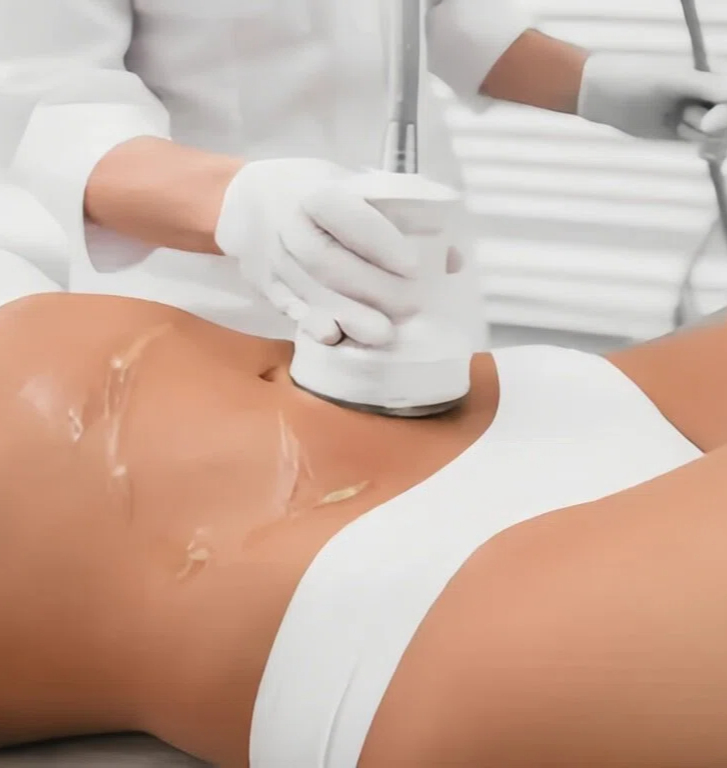 Máquina de Cavitación: ¿Funciona Realmente para Perder Grasa